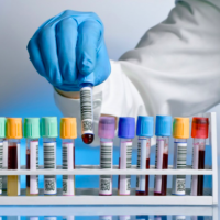 Сдача анализов. ИНВИТРО